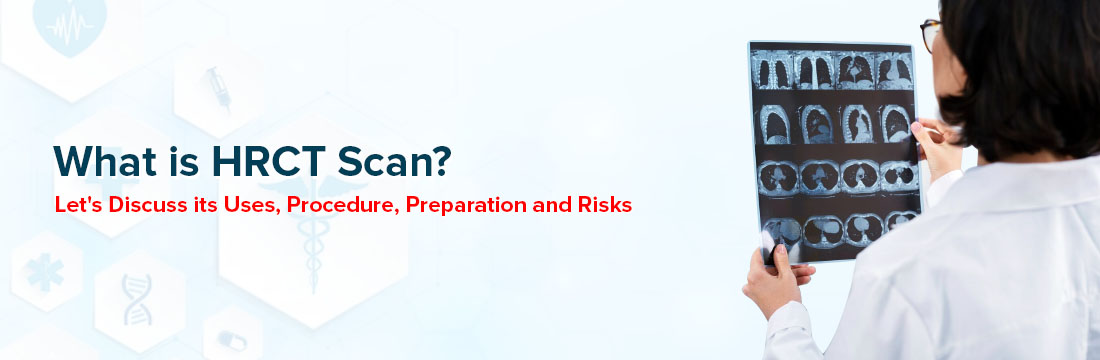 What is an HRCT Scan? Let Us Discuss Its Use, Procedure, Preparation and Risks